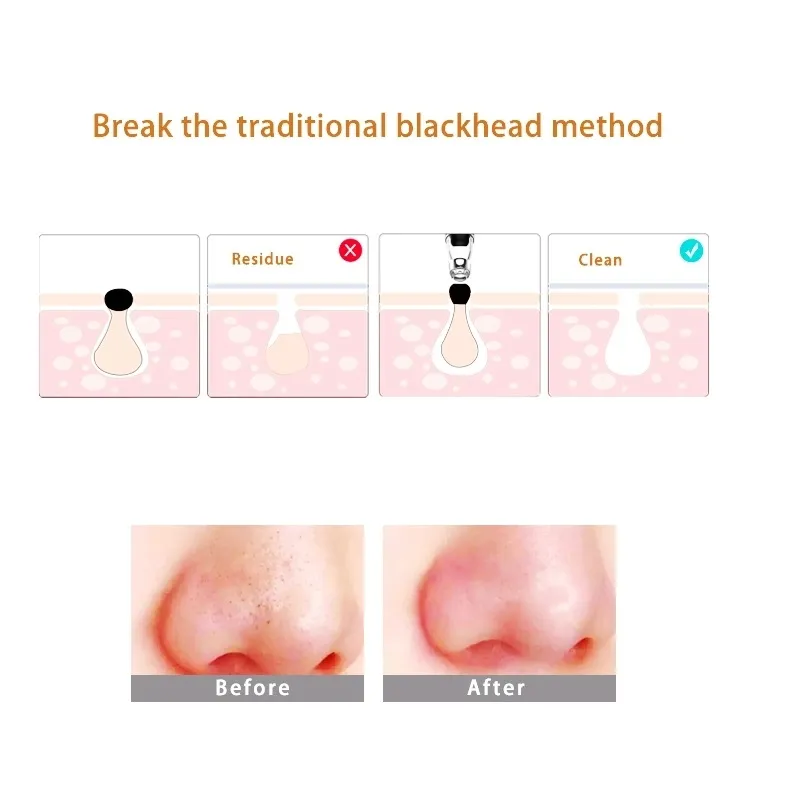 2020 Beauty Machine Pore Clean Pimple Vacuum Extract Blackhead Remover