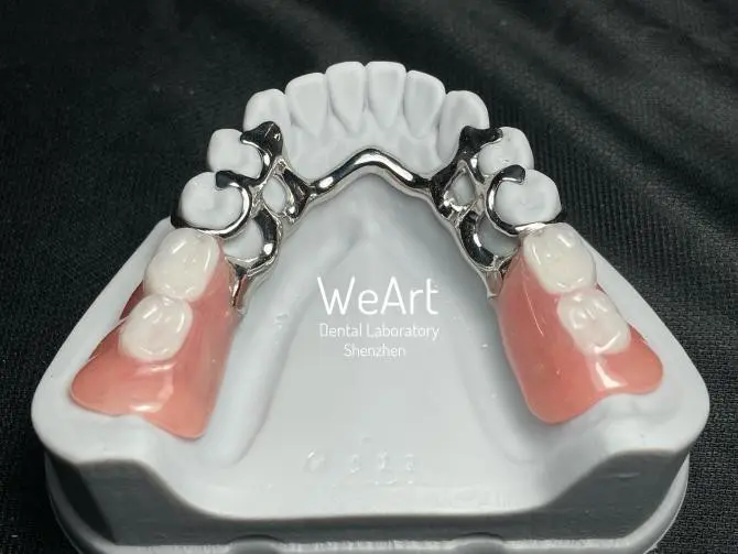 Why Choose Metal Partial Dentures for Lasting Comfort and Function?
