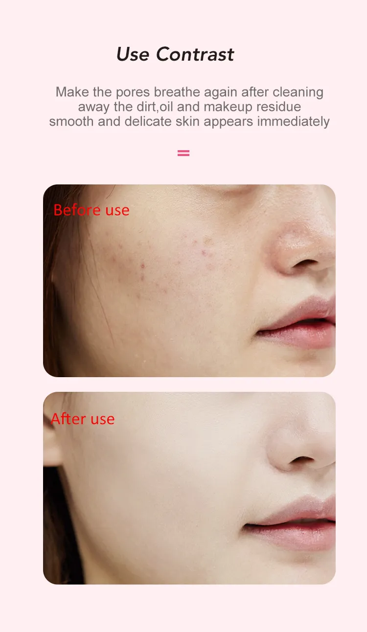 Silicone Sonic Face Cleaner Deep Pore Cleaning Skin Massager Face Cleansing Brush Device Mini Electric Facial Cleansing Brush