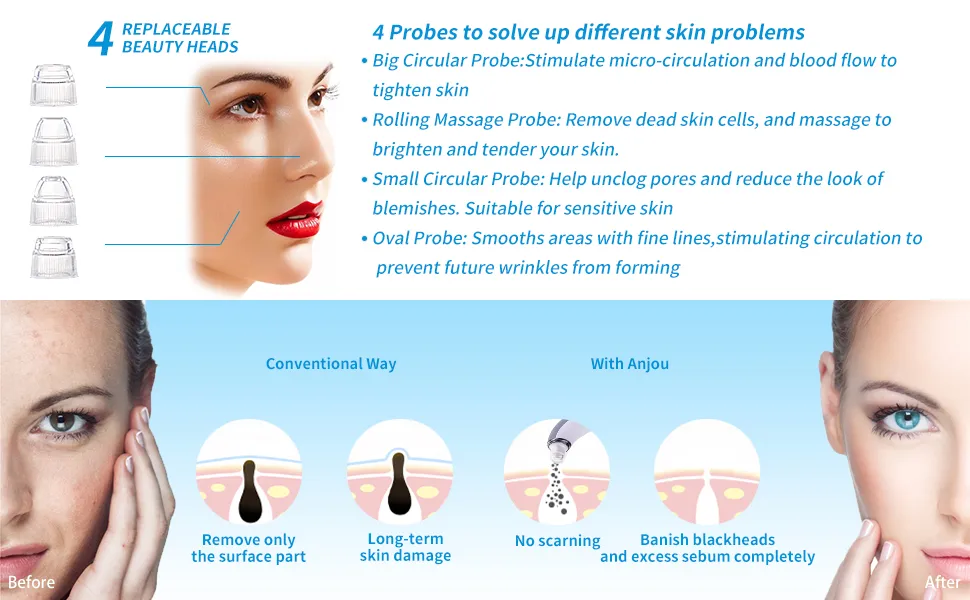 Vacuum Nose Facial Blackhead Remover for Beauty
